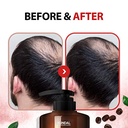 Kundal Caffeine Shampoo Cherry Blossom 500 Ml