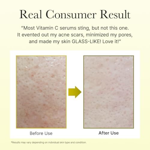 Arencia Vitamin C Booster Shot Brightening Serum - 30 ml - Product View 6 | Abdulghani Trading