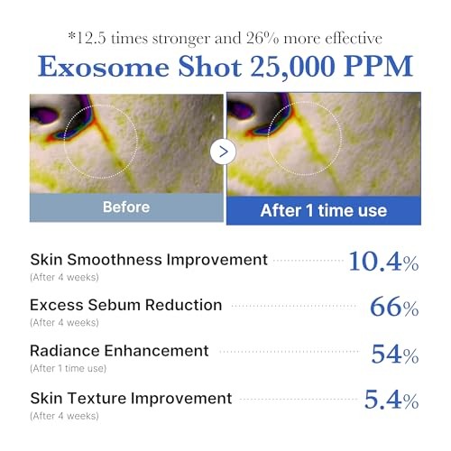 Medicube One Day Exosome Shot Pore Ampoule 25000 (13ml)