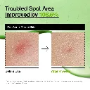 Anua Azelaic Acid 10 Hyaluron Redness Soothing Serum 30ml - Official Product Image | Abdulghani Trading