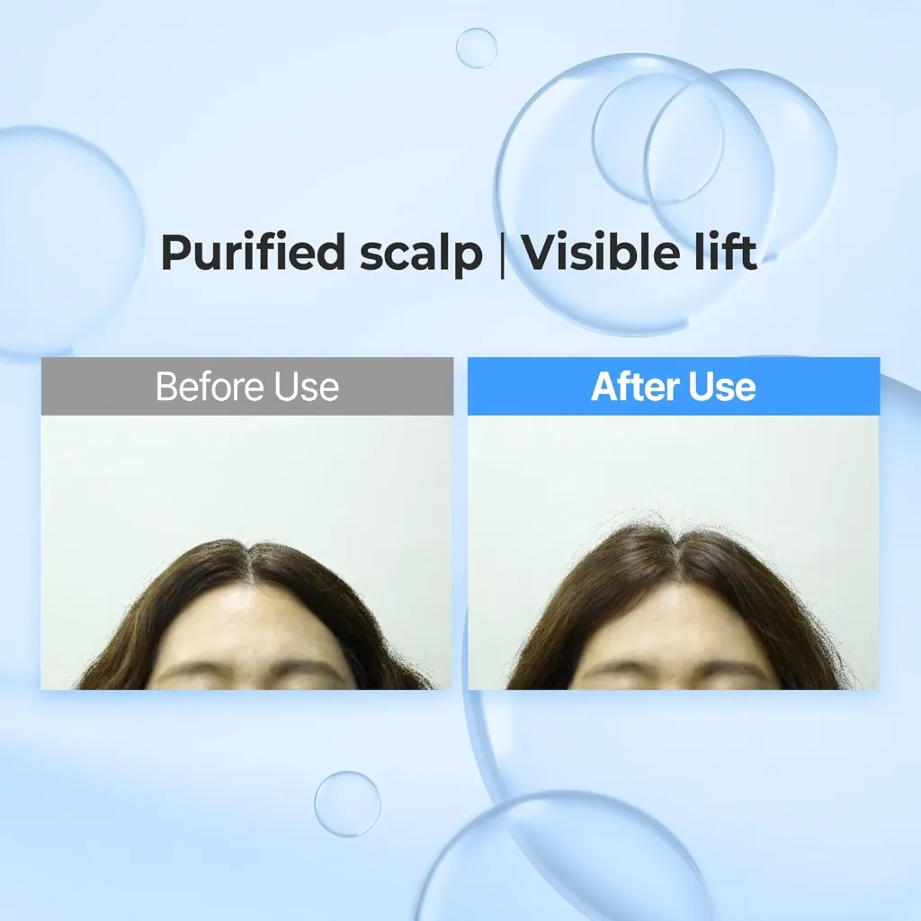 KUNDAL Airy Volume Hyaluron Hair Care Set (2x300ml) – Unisex - Product View 7 | Abdulghani Trading