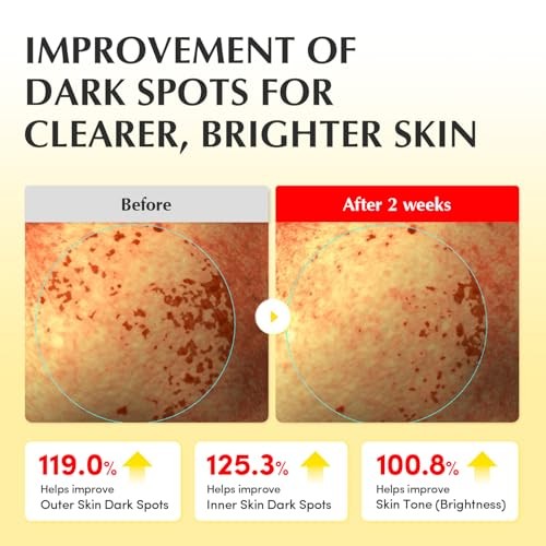 EQQUALBERRY Vitamin Illuminating Toner - Brightening Vitamin C & Niacinamide 3% | Gentle Daily Exfoliating | Skin-Prep Hydration for Glowy Skin(5.07 F