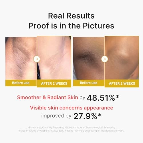 Medicube Body Peel Shot with Turmeric | Gentle Body Exfoliating Serum with BHA, LHA & PHA for Dead Skin Cells, Uneven Looking Skin & Excess Sebum | 9.