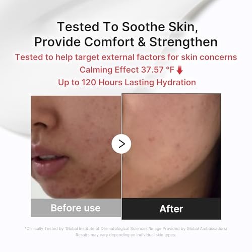 Medicube 3H Daily Relief Cream | Daily Soothing Moisturizer for All Skin Types | Lightweight Comforting Cream Ideal for Use After Spot Care | Guaiazul