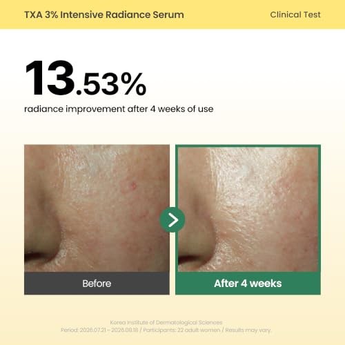 AXIS-Y TXA 3% Intensive Radiance Serum, Niacinamide 10%, 1.01 Fl. Oz. | Three-layer Korean Serum with Zinc PCA, Peptides and Capsules for Hydration, T