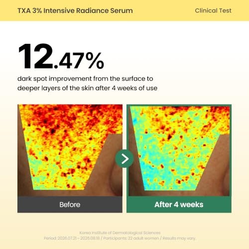 AXIS-Y TXA 3% Intensive Radiance Serum, Niacinamide 10%, 1.01 Fl. Oz. | Three-layer Korean Serum with Zinc PCA, Peptides and Capsules for Hydration, T