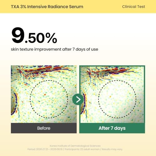 AXIS-Y TXA 3% Intensive Radiance Serum, Niacinamide 10%, 1.01 Fl. Oz. | Three-layer Korean Serum with Zinc PCA, Peptides and Capsules for Hydration, T