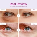Dr. Melaxin by Dr. Melaxin Cemenrete Calcium Volume Eye Patch -60ct for UNISEX